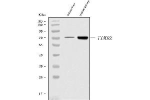 Western blot analysis of Tim 2/Timd2 using anti-Tim 2/Timd2 antibody (ABIN7602933).
