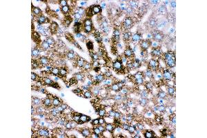 Anti- CYP2E1 antibody, IHC(P) IHC(P): Mouse Liver Tissue (CYP2E1 抗体  (AA 1-310))
