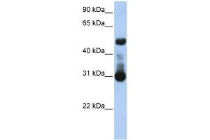 WB Suggested Anti-ACVRL1 Antibody Titration:  0. (ACVRL1 抗体  (N-Term))