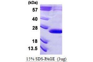 Vacuolar Protein Sorting 29 (VPS29) (AA 1-182) protein (His tag)