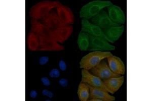 Fyn Mouse Monoclonal Antibody staining Hela cells by IF/ICC.