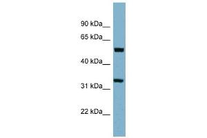 TMEM158 antibody used at 1 ug/ml to detect target protein. (TMEM158 抗体  (Middle Region))