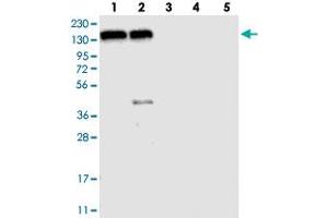 Western blot analysis of Lane 1: RT-4, Lane 2: U-251 MG, Lane 3: Human Plasma, Lane 4: Liver, Lane 5: Tonsil with FAM120A polyclonal antibody  at 1:250-1:500 dilution.