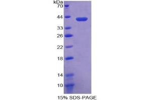 SDS-PAGE analysis of Human Crystallin lambda 1 Protein. (CRYL1 蛋白)