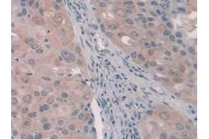 Immunohistochemistry (IHC) image for anti-serpin Peptidase Inhibitor, Clade A (Alpha-1 Antiproteinase, Antitrypsin), Member 5 (SERPINA5) (AA 43-406) antibody (ABIN7435505)
