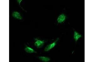 Image no. 5 for anti-Beclin 1, Autophagy Related (BECN1) antibody (ABIN1496869) (Beclin 1 抗体)