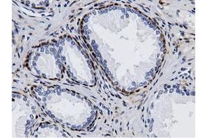 Immunohistochemical staining of paraffin-embedded Human liver tissue using anti-AK5 mouse monoclonal antibody. (Adenylate Kinase 5 抗体)