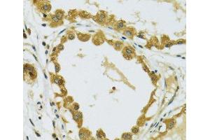 Immunohistochemistry of paraffin-embedded Human breast using RPS7 Polyclonal Antibody at dilution of 1:100 (40x lens). (RPS7 抗体)