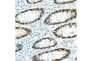 Immunohistochemistry (IHC) image for anti-Caudal Type Homeobox 2 (CDX2) antibody (ABIN7266152)