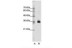 Image no. 1 for anti-Orthodenticle Homeobox 1 (OTX1) (C-Term) antibody (ABIN202328)