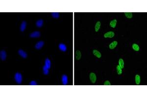 Immunofluorescence staining of HeLa cells using CBX1 monoclonal antibody, clone 5A3 (Green). (CBX1 抗体)