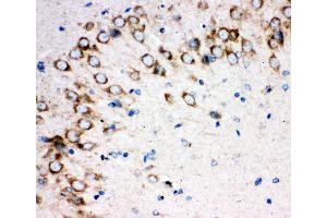 Anti-Sonic Hedgehog antibody,  IHC(P) IHC(P): Rat Brain Tissue (Sonic Hedgehog 抗体  (N-Term))