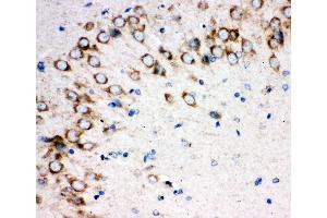 Anti-Sonic Hedgehog antibody,  IHC(P) IHC(P): Rat Brain Tissue