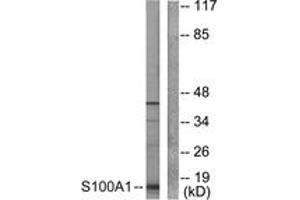 Western blot analysis of extracts from A549 cells, using S100 A1 Antibody. (S100A1 抗体  (AA 10-59))