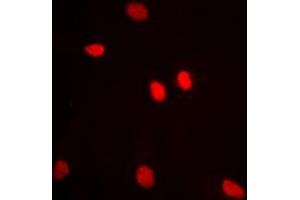 Immunofluorescent analysis of ADAR2 staining in MCF7 cells. (RED1 抗体  (Center))
