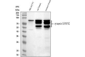 Western blot analysis of Synapsin II using anti-Synapsin II antibody (ABIN4886735). (SYN2 抗体  (AA 497-582))