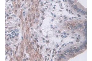 IHC-P analysis of Mouse Uterus Tissue, with DAB staining. (HSF4 抗体  (AA 159-411))