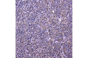 IHC analysis of cortactin using anti-cortactin antibody (ABIN6719306). (Cortactin 抗体  (AA 1-105))