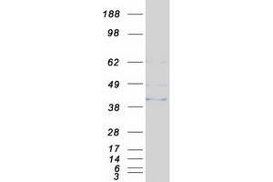 Western Blotting (WB) image for anthrax Toxin Receptor 1 (ANTXR1) (Transcript Variant 3) protein (Myc-DYKDDDDK Tag) (ABIN2714755)