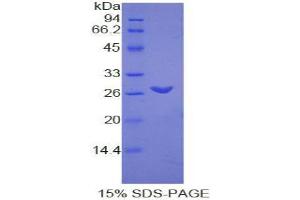 SDS-PAGE analysis of Rat TMEM173 Protein. (STING/TMEM173 蛋白)