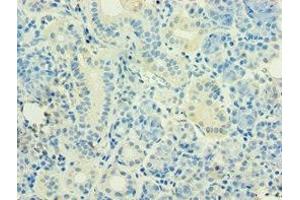 Immunohistochemistry of paraffin-embedded human pancreatic tissue using ABIN7155743 at dilution of 1:100 (HOXB5 抗体  (AA 1-170))