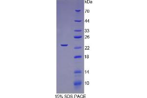 SDS-PAGE analysis of Rat TNNI1 Protein. (TNNI1 蛋白)