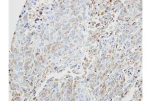 IHC-P Image Immunohistochemical analysis of paraffin-embedded H3347 xenograft, using PRKX, antibody at 1:500 dilution. (PRKX 抗体)
