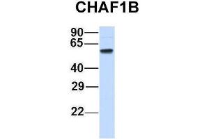 Host:  Rabbit  Target Name:  CHAF1B  Sample Type:  Human Adult Placenta  Antibody Dilution:  1. (CHAF1B 抗体  (N-Term))