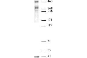 SMRT / NCoR2 antibody (pAb) tested by Western blot. (NCOR2 抗体  (N-Term))