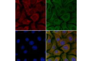 ABIN6257444 and ABIN6275462 staining Hela cells by IF/ICC.