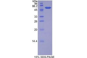 SDS-PAGE analysis of Human BSDL Protein. (Lipase, Bile Salt Dependent 蛋白)