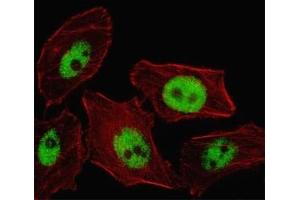 Fluorescent image of U251 cell stained with PHOX2B antibody. (PHOX2B 抗体  (AA 104-130))