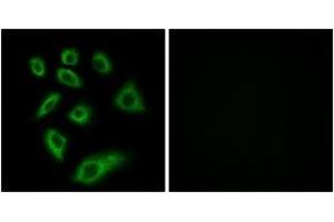 Immunofluorescence (IF) image for anti-Cytochrome P450, Family 2, Subfamily W, Polypeptide 1 (CYP2W1) (AA 311-360) antibody (ABIN2889950) (CYP2W1 抗体  (AA 311-360))