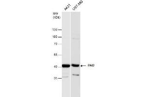 WB Image PAI2 antibody detects PAI2 protein by western blot analysis. (SERPINB2 抗体  (Center))