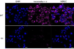Immunocytochemical staining of Hela cells using Peroxiredoxin 3 antibody (ABIN7799778), 1:1,000), Top panel: wild-type (WT), Bottom panal: Peroxiredoxin 3 shRNA knockdown (KD). (Recombinant Peroxiredoxin 3 抗体)