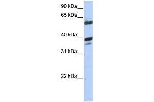 WB Suggested Anti-DNAJB1 Antibody Titration: 0. (DNAJB1 抗体  (N-Term))
