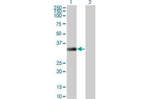 Western Blot analysis of ITPK1 expression in transfected 293T cell line by ITPK1 monoclonal antibody (M01), clone 2C8. (ITPK1 抗体  (AA 1-314))