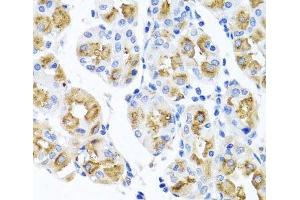 Immunohistochemistry of paraffin-embedded Human stomach using FECH Polyclonal Antibody at dilution of 1:100 (40x lens). (FECH 抗体)