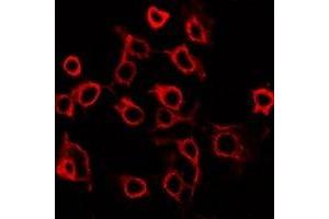 Immunofluorescent analysis of EP2 staining in HuvEc cells. (PTGER2 抗体  (C-Term))