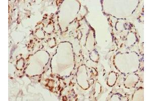 Immunohistochemistry of paraffin-embedded human thyroid tissue using ABIN7163952 at dilution of 1:100 (KCNA3 抗体  (AA 486-575))