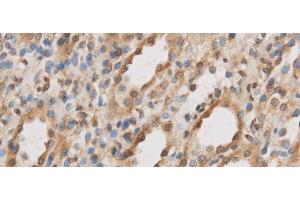 Immunohistochemistry of paraffin-embedded Rat kidney using IL10RB Polyclonal Antibody at dilution of 1:50 (IL10RB 抗体)