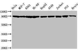 Western Blot Positive WB detected in: Hela whole cell lysate, MCF-7 whole cell lysate, K562 whole cell lysate, HL-60 whole cell lysate, HepG2 whole cell lysate, A549 whole cell lysate, Jurkat whole cell lysate, PC3 whole cell lysate, Rat brain tissue All lanes: Hsp90 alpha + beta antibody at 1.