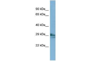 WB Suggested Anti-LIM2 Antibody Titration:  0. (LIM2 抗体  (N-Term))