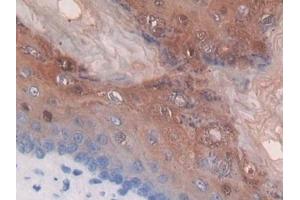 Detection of TP in Mouse Stomach Tissue using Polyclonal Antibody to Thymidine Phosphorylase (TP) (Thymidine Phosphorylase 抗体  (AA 29-305))