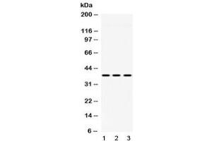 Western blot testing of 1) rat liver, 2) mouse heart and 3) human HeLa lysate with GNB1 antibody at 0.