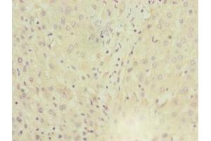 Immunohistochemistry of paraffin-embedded human liver tissue using ABIN7143763 at dilution of 1:100 (MGAT1 抗体  (AA 156-445))