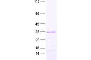 Western Blotting (WB) image for Sperm-Tail PG-Rich Repeat Containing 1 (STPG1) protein (His tag) (ABIN2718563)