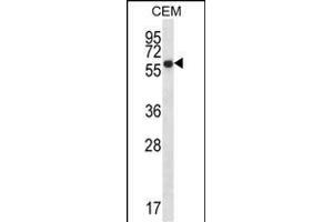 ERO1L Antibody (C-term) (ABIN657228 and ABIN2846330) western blot analysis in CEM cell line lysates (35 μg/lane). (ERO1L 抗体  (C-Term))