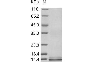 Zika Virus Envelope (ZIKV E) (AA 593-699) protein (His tag)