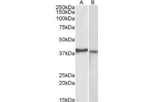 ABIN5539502 (2µg/ml) staining of Kelly (A) and U251-MG (B) lysates (35µg protein in RIPA buffer). (CX3CR1 抗体  (AA 34-47))